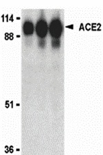 ACE2 Antibody