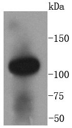 Anti-ACE2 Rab mAb (Clone: SN0754)