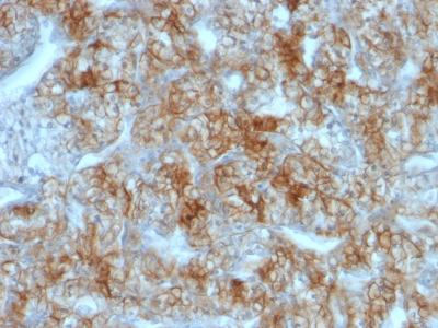 Monoclonal Antibody to Ksp-Cadherin (Kidney-Specific Cadherin) / CDH16(Clone : CDH16/1071)