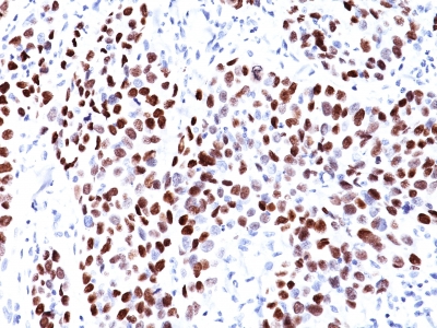 Monoclonal Antibody to p21WAF1 (Tumor Suppressor Protein)(Clone : CIP1/823)