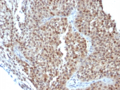 Monoclonal Antibody to p21WAF1 (Tumor Suppressor Protein)(CIP1/823 + DCS-60.2)