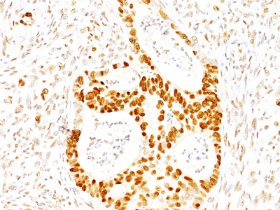 Monoclonal Antibody to p27Kip1 (Mitotic Inhibitor/Suppressor Protein)(Clone : SX53G8)