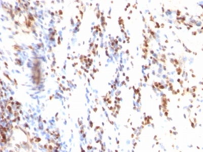 Monoclonal Antibody to p27Kip1 (Mitotic Inhibitor/Suppressor Protein)(Clone : KIP1/769)