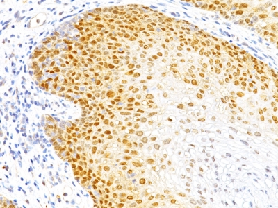 Monoclonal Antibody to p27Kip1 (Mitotic Inhibitor/Suppressor Protein)(Clone : DCS-72.F6)