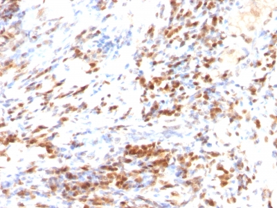 Monoclonal Antibody to p27Kip1 (Mitotic Inhibitor/Suppressor Protein)(DCS-72.F6 + KIP1/769)