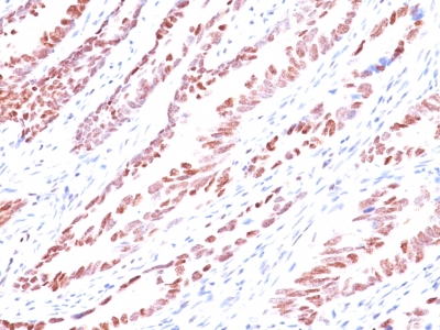 Monoclonal Antibody to p57Kip2 (Mitotic Inhibitor/Suppressor Protein)(Clone : KP10)