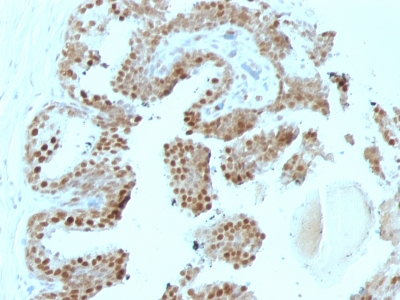 Monoclonal Antibody to p57Kip2 (Mitotic Inhibitor/Suppressor Protein)(Clone : SPM308)