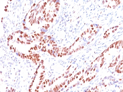 Monoclonal Antibody to p57Kip2 (Mitotic Inhibitor/Suppressor Protein)(Clone : KIP2/880)