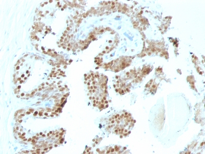 Monoclonal Antibody to p57Kip2 (Mitotic Inhibitor/Suppressor Protein)(KP10 + KIP2/880)(Discontinued)