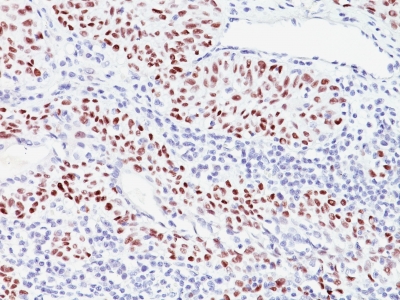 Monoclonal Antibody to p57Kip2 (Mitotic Inhibitor/Suppressor Protein)(Clone : 57P06)