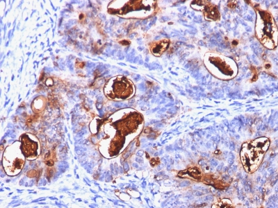 Monoclonal Antibody to Carcinoembryonic Antigen (CEA) / CD66(Clone : C66/1260)