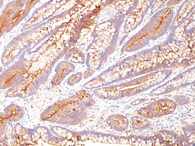 Monoclonal Antibody to Carcinoembryonic Antigen (CEA) / CD66(Clone : SPM584)