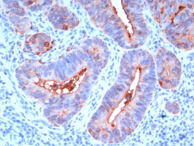 Monoclonal Antibody to Carcinoembryonic Antigen (CEA) / CD66(Clone : C66/195)