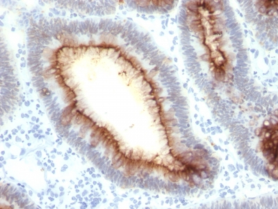 Monoclonal Antibody to Carcinoembryonic Antigen (CEA) / CD66(Clone : SPM330)