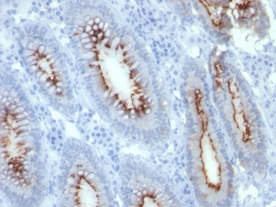 Monoclonal Antibody to Carcinoembryonic Antigen (CEA) / CD66(Clone : C66/261)