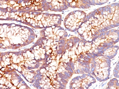 Monoclonal Antibody to Carcinoembryonic Antigen (CEA) / CD66(Clone : CEA31)