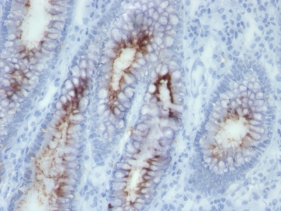 Monoclonal Antibody to Carcinoembryonic Antigen (CEA) / CD66(Clone : SPM506)