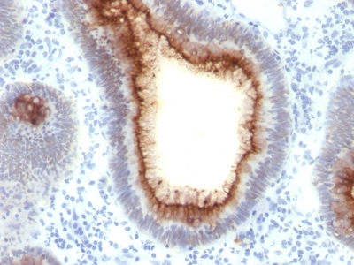 Monoclonal Antibody to Carcinoembryonic Antigen (CEA) / CD66(Clone : C66/1009)