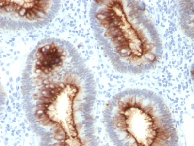 Monoclonal Antibody to Carcinoembryonic Antigen (CEA) / CD66(Clone : C66/1030)