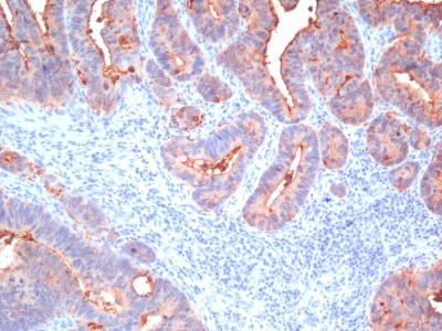 Monoclonal Antibody to Carcinoembryonic Antigen, pan (CEA) / CD66(Clone : Cocktail)