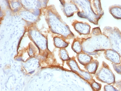 Monoclonal Antibody to HCG-alpha (Pregnancy & Choriocarcinoma Marker)(Clone : SPM552)