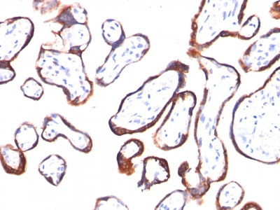 Monoclonal Antibody to HCG-beta (Pregnancy & Choriocarcinoma Marker)(Clone : HCGb/54)