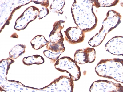 Monoclonal Antibody to HCG-beta (Pregnancy & Choriocarcinoma Marker)(Clone : HCGb/459)