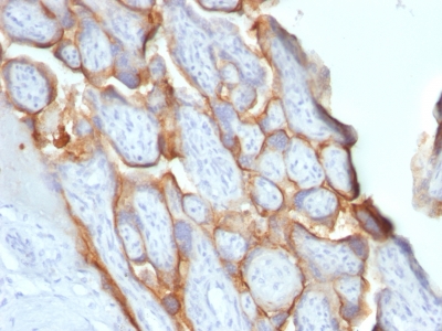 Monoclonal Antibody to HCG-beta (Pregnancy & Choriocarcinoma Marker)(Clone : SPM529)