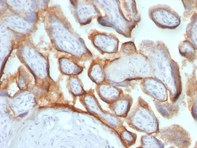 Monoclonal Antibody to HCG-beta (Pregnancy & Choriocarcinoma Marker)(HCGb/54 + HCGb/459)