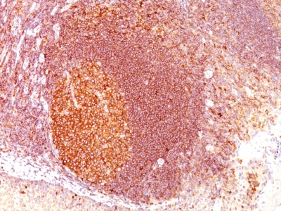 Monoclonal Antibody to MALT1 (MALT-Lymphoma Marker)(Clone : SPM578)