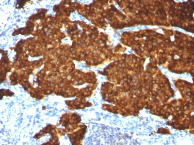 Monoclonal Antibody to Chromogranin A / CHGA (Neuroendocrine Marker)(Clone: CGA/413 + CHGA/777 + CHGA/798)