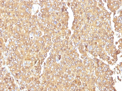 Monoclonal Antibody to Chromogranin A / CHGA (Neuroendocrine Marker)(Clone : LK2H10)