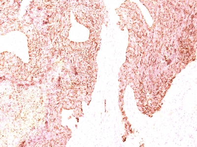 Monoclonal Antibody to Chromogranin A / CHGA (Neuroendocrine Marker)(Clone : SPM339)