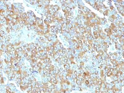 Monoclonal Antibody to Chromogranin A / CHGA (Neuroendocrine Marker)(Clone : PHE5)