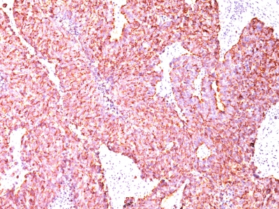 Monoclonal Antibody to Chromogranin A / CHGA (Neuroendocrine Marker)(Clone : SPM585)