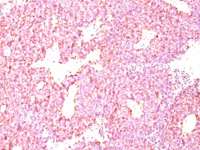 Monoclonal Antibody to Chromogranin A / CHGA (Neuroendocrine Marker)(Clone: LK2H10 + PHE5)