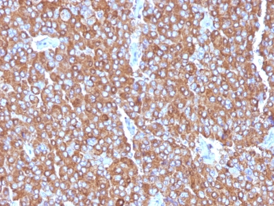 Monoclonal Antibody to Chromogranin A / CHGA (Neuroendocrine Marker)(LK2H10 + PHE5 + CGA/414)