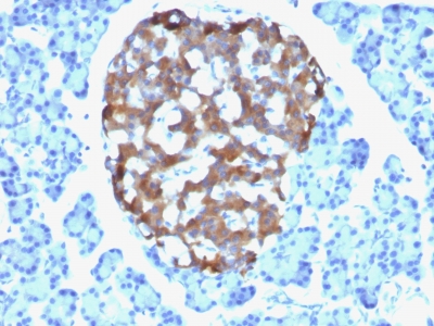 Monoclonal Antibody to Chromogranin A / CHGA (Neuroendocrine Marker)(Clone : CHGA/765)