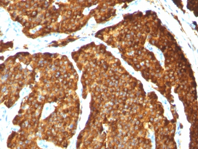 Monoclonal Antibody to Chromogranin A / CHGA (Neuroendocrine Marker)(Clone : CHGA/777)