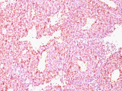 Monoclonal Antibody to Chromogranin A / CHGA (Neuroendocrine Marker)(Clone : CHGA/798)