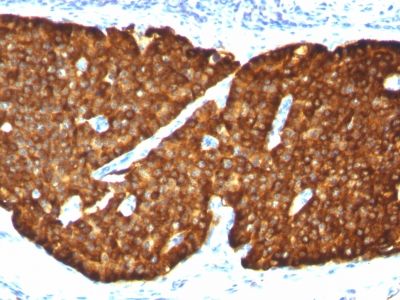 Monoclonal Antibody to Chromogranin A / CHGA (Neuroendocrine Marker)(Clone : CGA/413)