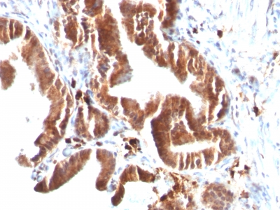 Monoclonal Antibody to Topoisomerase (DNA) I, Mitochondrial (TOP1MT)(Clone : TOP1MT/488)