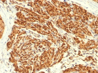 Monoclonal Antibody to Calponin-1 (Smooth Muscle Marker)(Clone : CALP)