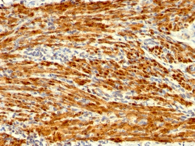 Monoclonal Antibody to Calponin-1 (Smooth Muscle Marker)(Clone : SPM169)