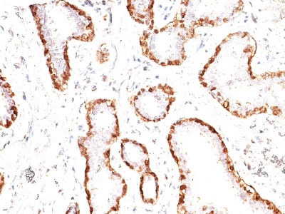 Monoclonal Antibody to Calponin-1 (Smooth Muscle Marker)(Clone : CNN1/832)