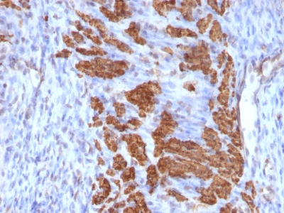 Monoclonal Antibody to Calponin-1 (Smooth Muscle Marker)(Clone : CNN1/832 + CALP)