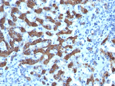 Monoclonal Antibody to CPS1 / Carbamoyl-Phosphate Synthetase (Hepatocellular Marker)(Clone : CPS1/1022)