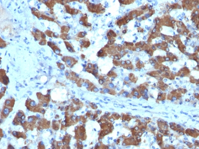 Monoclonal Antibody to CPS1 / Carbamoyl-Phosphate Synthetase (Hepatocellular Marker)(Clone : SPM615)