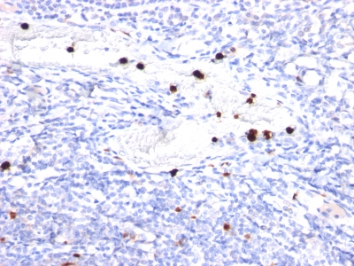 Monoclonal Antibody to Granulocyte-Colony Stimulating Factor (G-CSF)(Clone : CSF3/900)