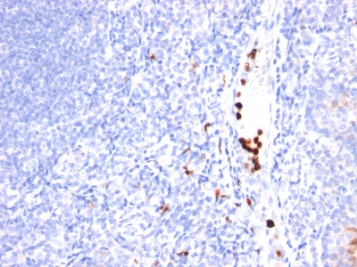 Monoclonal Antibody to Granulocyte-Colony Stimulating Factor (G-CSF)(Clone : SPM468)